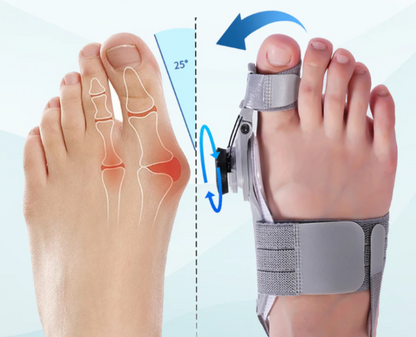 Corrector y alineador de dedos PodiFlex